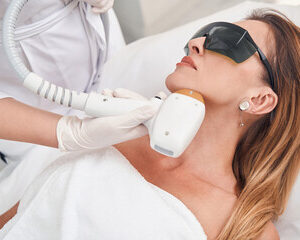 épilation au laser du visage